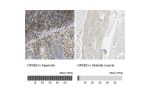 Immunohistochemistry analysis in human appendix and skeletal muscle tissues using Anti-NFKB2 antibody. Corresponding NFKB2 RNA-seq data are presented for the same tissues.