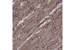 Immunohistochemical staining of human heart muscle shows cytoplasmic and membranous positivity in myocytes.