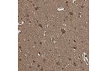 Immunohistochemical staining of human cerebral cortex shows strong nuclear and cytoplasmic positivity in neuronal cells.
