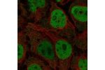 Immunofluorescent staining of human cell line CACO-2 shows localization to nucleoplasm & nucleoli fibrillar center.