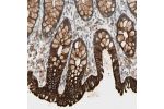 Immunohistochemical staining of human colon shows strong cytoplasmic positivity in glandular cells.