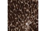 Immunohistochemical staining of human liver shows strong cytoplasmic and nuclear positivity in hepatocytes.