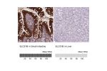 Immunohistochemistry analysis in human small intestine and liver tissues using HPA008533 antibody. Corresponding SLC51B RNA-seq data are presented for the same tissues.