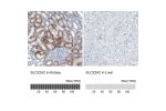 Immunohistochemistry analysis in human kidney and liver tissues using HPA008567 antibody. Corresponding SLC22A2 RNA-seq data are presented for the same tissues.