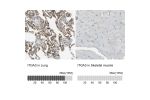 Immunohistochemistry analysis in human lung and skeletal muscle tissues using HPA008572 antibody. Corresponding ITGA3 RNA-seq data are presented for the same tissues.