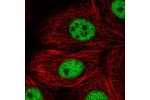 Immunofluorescent staining of human cell line MCF7 shows localization to nucleoplasm.