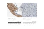 Immunohistochemistry analysis in human placenta and pancreas tissues using HPA008612 antibody. Corresponding TGFBI RNA-seq data are presented for the same tissues.