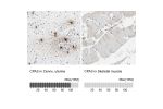 Immunohistochemistry analysis in human cervix, uterine and skeletal muscle tissues using HPA008689 antibody. Corresponding CPA3 RNA-seq data are presented for the same tissues.