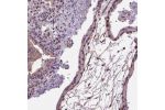 Immunohistochemical staining of human placenta shows moderate membranous/cytoplasmic positivity in trophoblastic cells.