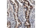 Immunohistochemical staining of human duodenum shows strong cytoplasmic positivity in glandular cells.