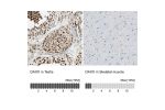 Immunohistochemistry analysis in human testis and skeletal muscle tissues using HPA008736 antibody. Corresponding DAXX RNA-seq data are presented for the same tissues.