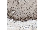 Immunohistochemical staining of human esophagus shows moderate to strong nuclear positivity in squamous epithelial cells.