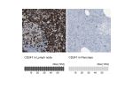 Immunohistochemistry analysis in human lymph node and pancreas tissues using HPA008750 antibody. Corresponding CD247 RNA-seq data are presented for the same tissues.