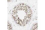 Immunohistochemical staining of human testis shows strong nuclear positivity in cells in seminiferous ducts.