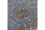 Immunohistochemical staining of human lymph node shows distinct nuclear positivity in germinal center cells.