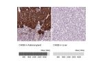 Immunohistochemistry analysis in human adrenal gland and liver tissues using HPA008759 antibody. Corresponding CHGB RNA-seq data are presented for the same tissues.