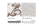 Immunohistochemistry analysis in human placenta and skeletal muscle tissues using HPA008763 antibody. Corresponding GRN RNA-seq data are presented for the same tissues.