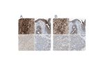 Immunohistochemical staining of human adrenal gland, endometrium, liver and pancreas using Anti-ALPL antibody HPA008765 (A) shows similar protein distribution across tissues to independent antibody HPA007105 (B).