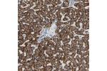 Immunohistochemical staining of human liver shows strong cytoplasmic positivity in hepatocytes.