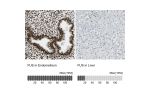 Immunohistochemistry analysis in human endometrium and liver tissues using HPA008784 antibody. Corresponding FUS RNA-seq data are presented for the same tissues.