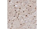 Immunohistochemical staining of human heart muscle shows strong nuclear positivity in cardiomyocytes.