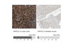 Immunohistochemistry analysis in human lymph node and skeletal muscle tissues using HPA008789 antibody. Corresponding NFATC2 RNA-seq data are presented for the same tissues.