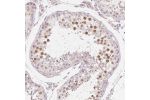 Immunohistochemical staining of human Testis shows moderate nuclear positivity in cells in seminiferous ducts.