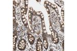 Immunohistochemical staining of human colon shows strong cytoplasmic positivity in glandular cells.