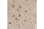 Immunohistochemical staining of human cerebral cortex shows distinct cytoplasmic positivity in neurons.