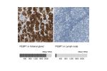 Immunohistochemistry analysis in human adrenal gland and lymph node tissues using HPA008819 antibody. Corresponding PEBP1 RNA-seq data are presented for the same tissues.