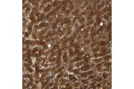 Immunohistochemical staining of human liver shows strong cytoplasmic positivity in hepatocytes.