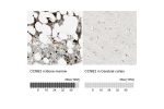 Immunohistochemistry analysis in human bone marrow and cerebral cortex tissues using Anti-CCNB2 antibody. Corresponding CCNB2 RNA-seq data are presented for the same tissues.
