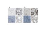 Immunohistochemical staining of human cerebral cortex, gastrointestinal, lymphoid tissues and testis using Anti-NFIA antibody HPA008884 (A) shows similar protein distribution across tissues to independent antibody HPA006111 (B).