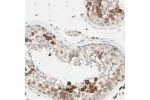 Immunohistochemical staining of human testis shows strong cytoplasmic positivity in cells in seminiferus ducts.
