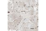 Immunohistochemical staining of human skeletal muscle shows strong nuclear positivity in myocytes.