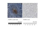 Immunohistochemistry analysis in human lymph node and liver tissues using HPA008928 antibody. Corresponding FCER2 RNA-seq data are presented for the same tissues.