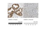 Immunohistochemistry analysis in human prostate and pancreas tissues using HPA008932 antibody. Corresponding ENDOD1 RNA-seq data are presented for the same tissues.