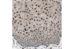 Immunohistochemical staining of human cervix shows strong nuclear positivity in squamous epithelial cells.