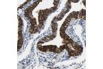 Immunohistochemical staining of human Fallopian tube shows strong membranous positivity in glandular cells.