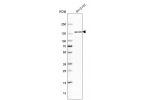 Western blot analysis in human cell line SH-SY5Y.