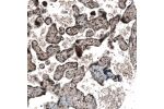 Immunohistochemical staining of human Placenta shows strong nuclear and cytoplasmic positivity in trophoblastic cells.