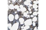 Immunohistochemical staining of human bone marrow shows strong cytoplasm granular positivity in hematopoietic cells.