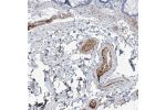 Immunohistochemical staining of human colon shows distinct positivity in plasma.