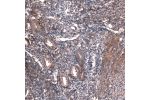Immunohistochemical staining of human Heart muscle shows moderate cytoplasmic positivity in cardiomyocytes.