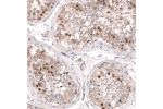Immunohistochemical staining of human testis shows moderate cytoplasmic and stronger nuclear positivity in cells in seminiferous ducts.
