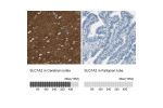 Immunohistochemistry analysis in human cerebral cortex and fallopian tube tissues using HPA009172 antibody. Corresponding SLC1A2 RNA-seq data are presented for the same tissues.