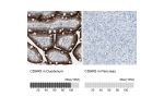 Immunohistochemistry analysis in human duodenum and pancreas tissues using HPA009173 antibody. Corresponding CDHR5 RNA-seq data are presented for the same tissues.