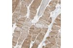 Immunohistochemical staining of human pancreas shows strong cytoplasmic positivity in exocrine glandular cells.