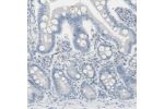 Immunohistochemical staining of human duodenum shows no positivity in glandular cells as expected.