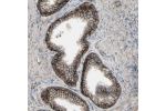 Immunohistochemistry analysis in human prostate and pancreas tissues using Anti-CD276 antibody. Corresponding CD276 RNA-seq data are presented for the same tissues.
